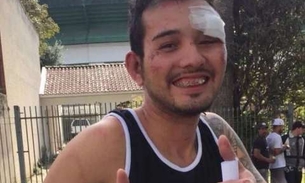 Após ser dado como morto, corintiano agredido por torcedores do Coritiba posta foto sorrindo