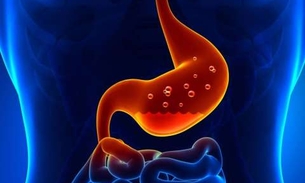 Para o fim da azia, refluxo, gastrite e úlcera com apenas 1 ingrediente