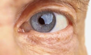 Rica em Vitamina A, consumo de fruta pode combater catarata 