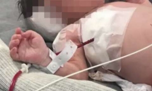 Bebê baleado na barriga da mãe no Rio, está paraplégico