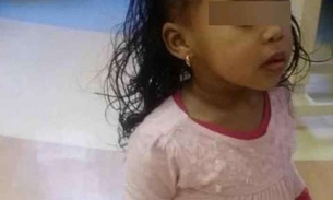 Mãe sente cheiro podre em filha de 18 meses e fica chocada ao descobrir o motivo