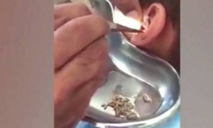 Criança reclama com fortes dores no ouvido e médicos ficam chocados