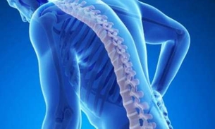 Consumo de alimento rico em Cálcio reduz riscos de osteoporose 