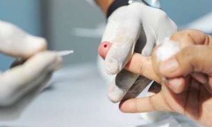 Campanha realiza teste gratuito de hepatite C em todo o Brasil 