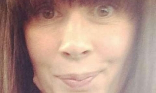 Após fazer sobrancelha definitiva, mulher pega infecção e fica irreconhecível