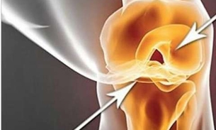 Essa bebida ajuda reconstruir cartilagem, ligamentos e acaba com dor nos joelhos