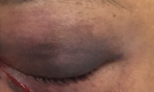 Em Manaus, homem é preso acusado de bater na ex-mulher a marteladas por não aceitar fim de relacionamento