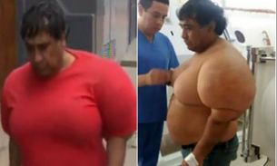 Mergulhador fica com corpo deformado após acidente bizarro
