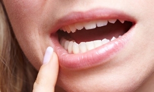 Bochecho com chá de planta é excelente alternativa para tratar aftas 