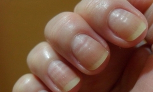 Produto natural é útil como amaciante, esfoliante e ainda combate fungos nas unhas 