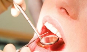 Semsa promove Semana de Saúde Bucal em UBSs de Manaus 