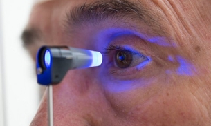 Glaucoma afetará 80 milhões de pessoas em 2020, diz OMS