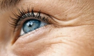 Elimine os pés de galinha do seu rosto com estas 6 dicas simples