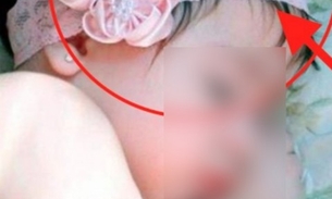Colocar faixa de cabelo em bebês pode deixar seu filho muito doente, afirma médico