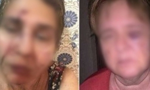 Briga entre vizinhos de prédio termina com três mulheres espancadas