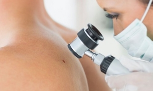 Mutirão com 700 consultas dermatológicas gratuitas acontece neste sábado