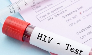 Soropositivos com carga viral indetectável não transmitem HIV, diz estudo