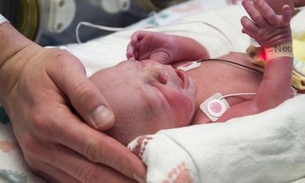 EUA registram 1º nascimento de bebê de mãe com útero transplantado