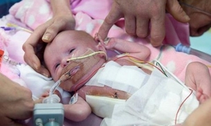 Bebê nasce com coração fora do corpo e surpreende médicos