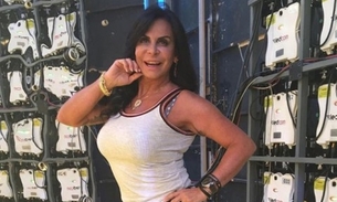 Gretchen surge com bocão e revela preenchimento labial