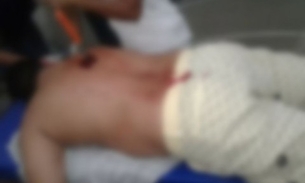 Homem é esfaqueado durante ceia de Natal e arma fica cravada nas costas