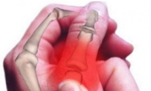 Elime todas as dores nas articulações com 16 dicas naturais 