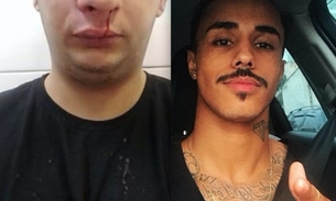 MC Livinho é acusado de agredir profissional apósshow 