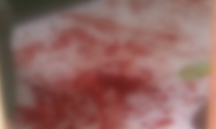 Após se conhecerem em manicômio, homem decapita esposa e cachorros de estimação