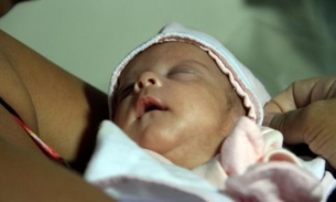 Após lutar para sobreviver, bebê mais prematura nascida em hospital público tem alta