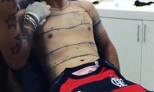  Após 1 ano, torcedor finaliza tatuagem de camisa do Flamengo em tamanho real