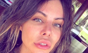 Modelo brasileira que processou Chris Brown está em coma na Turquia