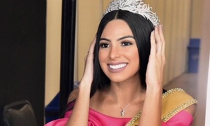 Miss Brasil Mayra Dias fala sobre preconceito, bullying e cirurgias 