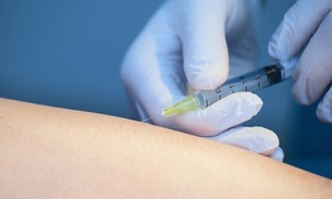 Associação médica alerta para riscos de tratamento contra varizes