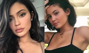 Kylie Jenner surge diferente e choca ao revelar que abandonou preenchimento labial