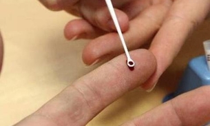 Hepatite: OMS pede urgência para ampliar testes e acesso a tratamento