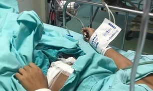 Jovem que teve estômago perfurado durante lipo será ouvida pela polícia no hospital