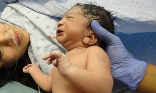 Com ‘epidemia’ de cesáreas, 4 em cada 10 bebês nascem antes do tempo ideal