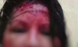Professora fica em estado grave após ser espancada e torturada pelo marido no Amazonas