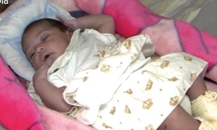 Com 3 dias de vida, bebê leva 7 picadas de escorpião escondido em fralda