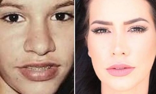  Ex-BBB Adriana aparece irreconhecível em foto antes de 2 cirurgias no nariz