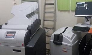 Hospitais do interior recebem digitalizadores de imagem para exames de mamografia e raio x 