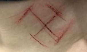  Delegado diz que suástica nazista marcada em jovem por apoiadores de Bolsonaro 'é símbolo budista'