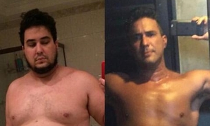 André Marques faz desabafo ao mostrar foto de antes e depois de cirurgia: 'Estava no fundo do poço'