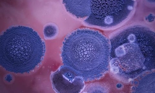 Infecções por superfungos devem se tornar mais comuns, diz pesquisador