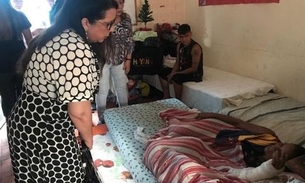 MP decide acompanhar o atendimento às vítimas de incêndio no Educandos 