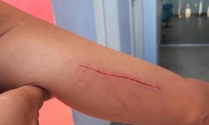 Adolescente afirma que foi estuprada após ser abordada por grupo de 12 homens em Manaus 