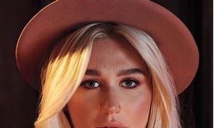 Lady Gaga diz que viu Kesha traumatizada e seminua em quarto de Dr. Luke