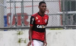  Atleta do Flamengo que teve quase 40% do corpo queimado é transferido