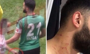 Jogador é investigado por atacar adversários com lâmina durante partida