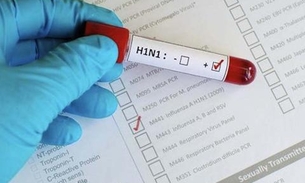 Amazonas tem quase 70 casos confirmados de H1N1 e número de óbitos sobe para 17